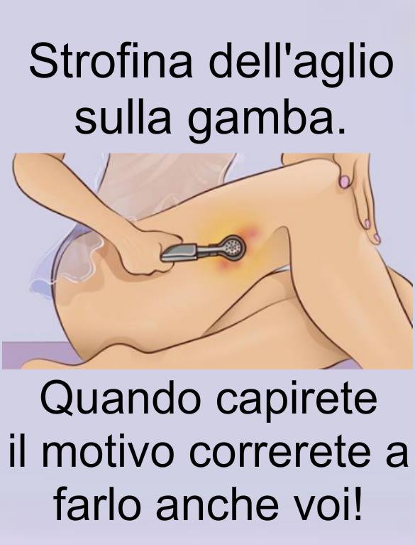 STROFINA DELL'AGLIO SULLA GAMBA: QUANDO CAPIRETE IL MOTIVO CORRERETE A FARLO ANCHE VOI - 03/11/2017